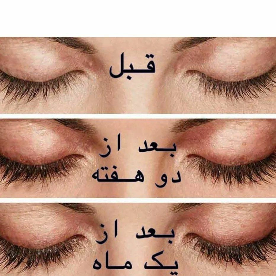 تقویت کننده رشد مژه وابرو